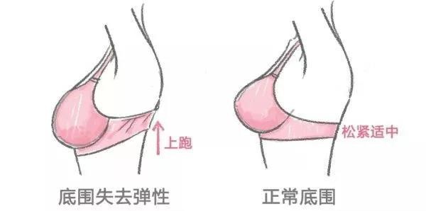 小细节体现大问题 你的内衣内裤该换新啦