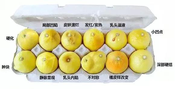 内衣穿着不当的危害 关于内衣穿着的小知识