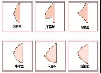 乳房“空杯” 难道只是因为胸小吗?