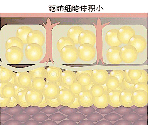 塑身衣能瘦身吗 这件穿上显瘦10斤“腹婆”变“腰精”