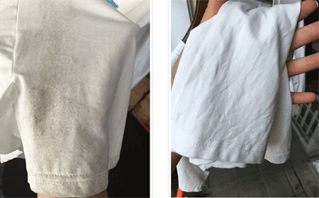 衣服发霉用什么洗掉霉斑 将衣服在太阳下暴晒