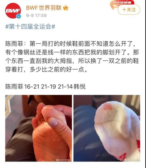 羽毛球运动员被李宁鞋划伤|李宁紧急回应,同款疑似下家