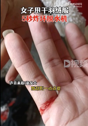 “女子甩干羽绒服5秒炸坏脱水机”冲上热搜 羽绒服应该怎么正确清洗晾晒